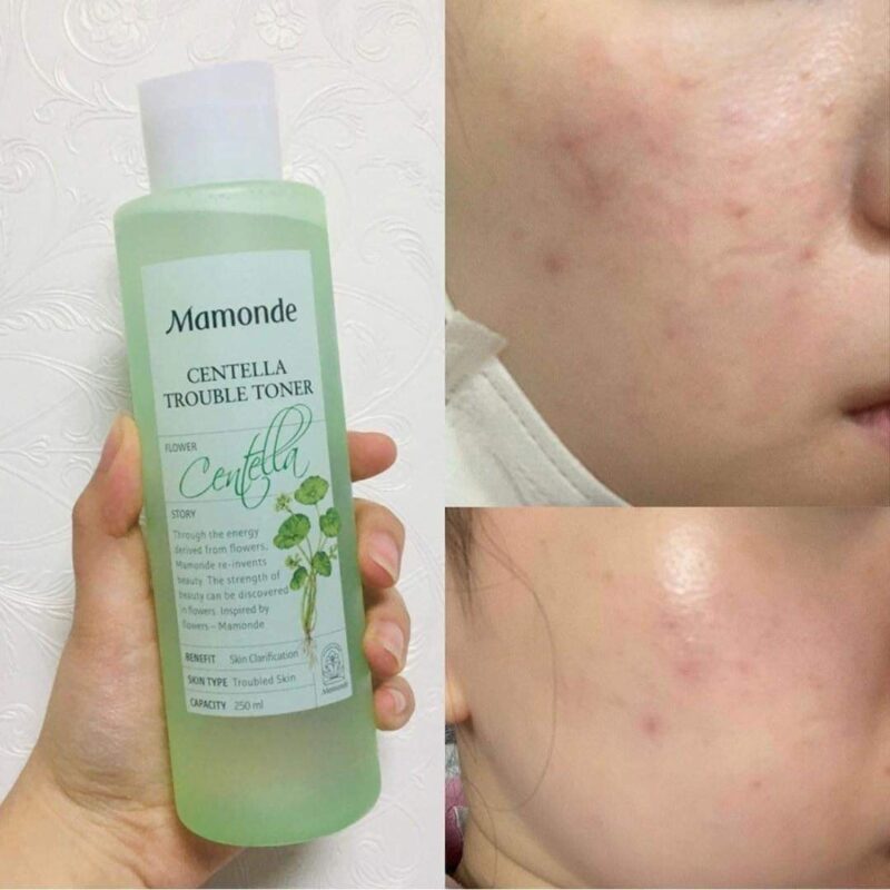 [mamonde] centella trouble toner 250ml - calm and soothe your troubled skin with our toner - image 5