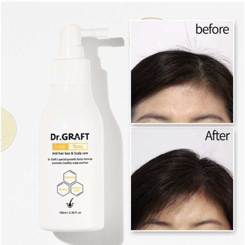 [dr. Graft] scalp tonic 100ml - nourish your scalp with our scalp tonic - image 7