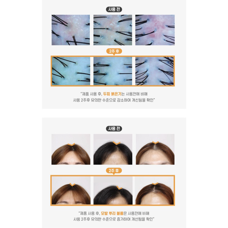 [dr. Graft] scalp tonic 100ml - nourish your scalp with our scalp tonic - image 9