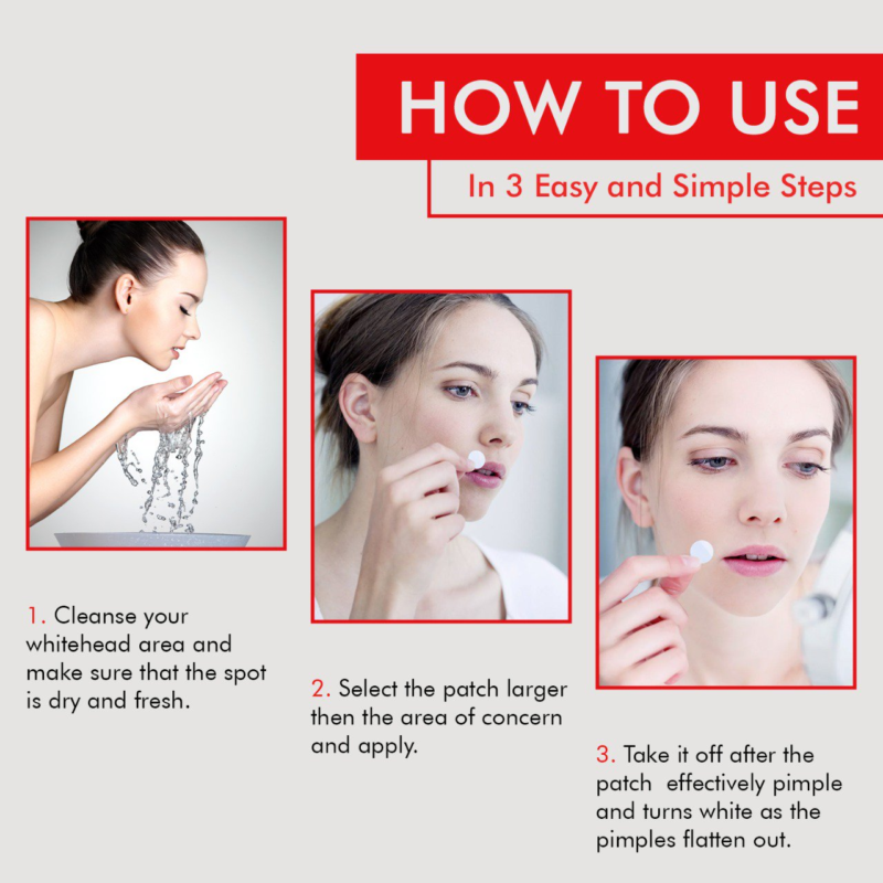 [cosrx] acne pimple master patch - treat and heal acne with our pimple patch - image 3