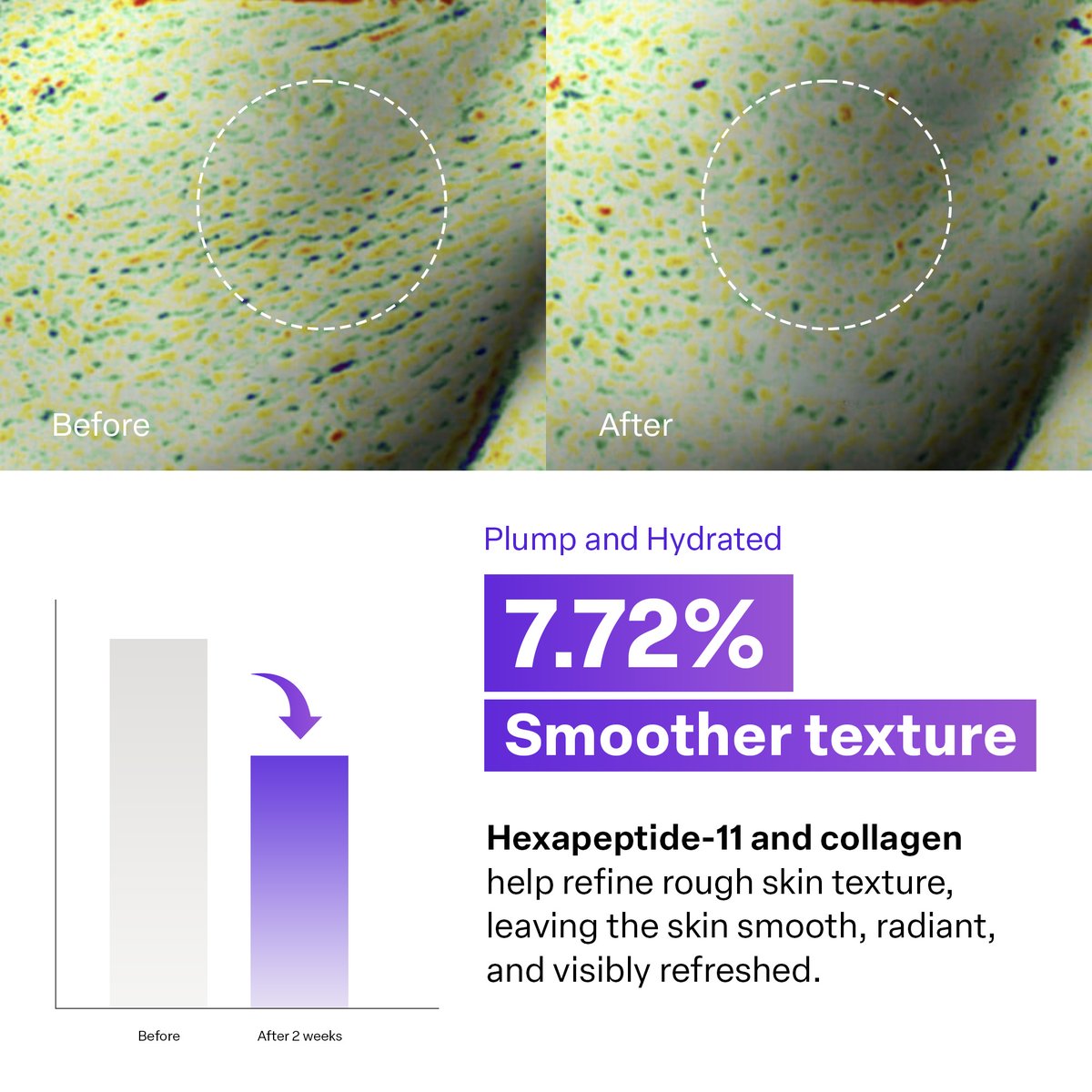Before and after skin texture comparison after 2 weeks of using Hexapeptide-11 and collagen serum