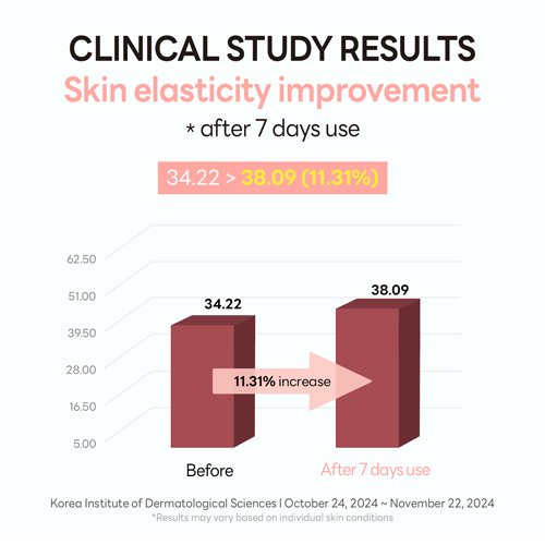 Elasticity study chart showing a 11.31 percent skin elasticity increase after 7 days of use